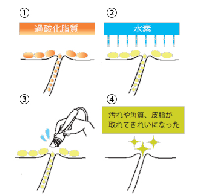 ハイドロスプラッシュ
